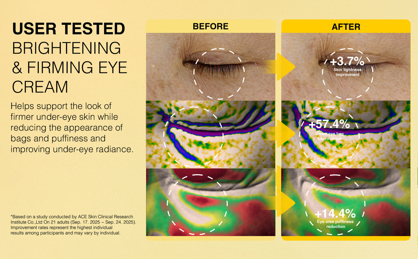 EYE LIFTING ROLLER CREAM